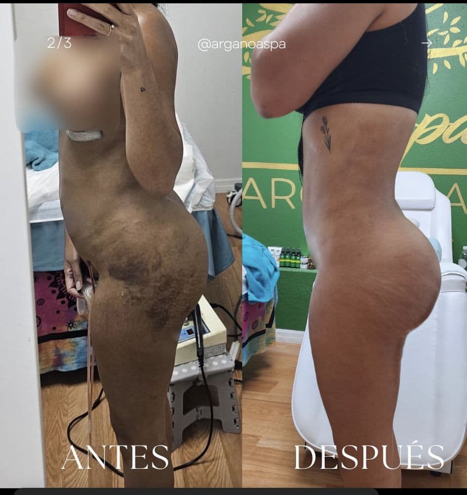 Arganoa Spa