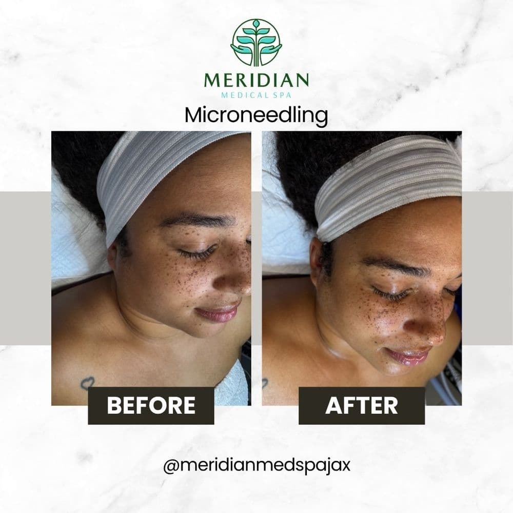 Meridian Medical Spa