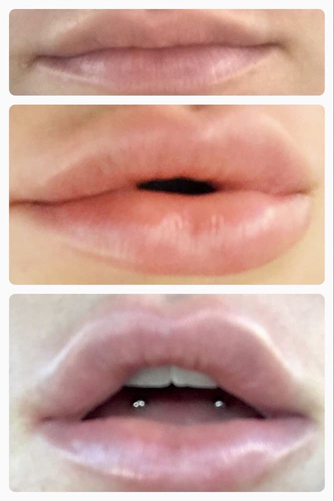 JeuneNu Aesthetic Beauty & Laser Center