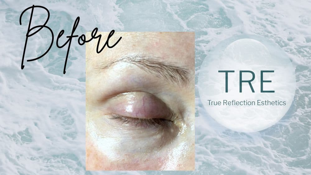 True Reflection Esthetics
