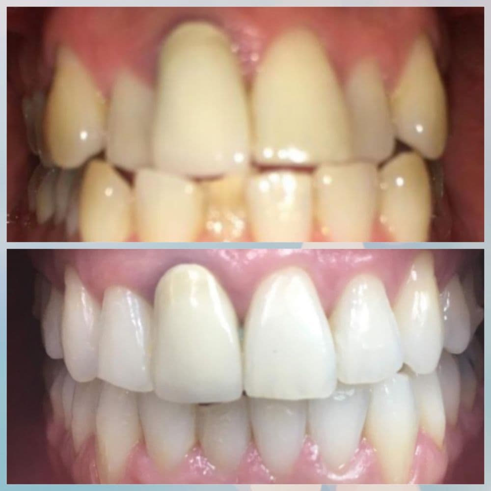 Dental Progress