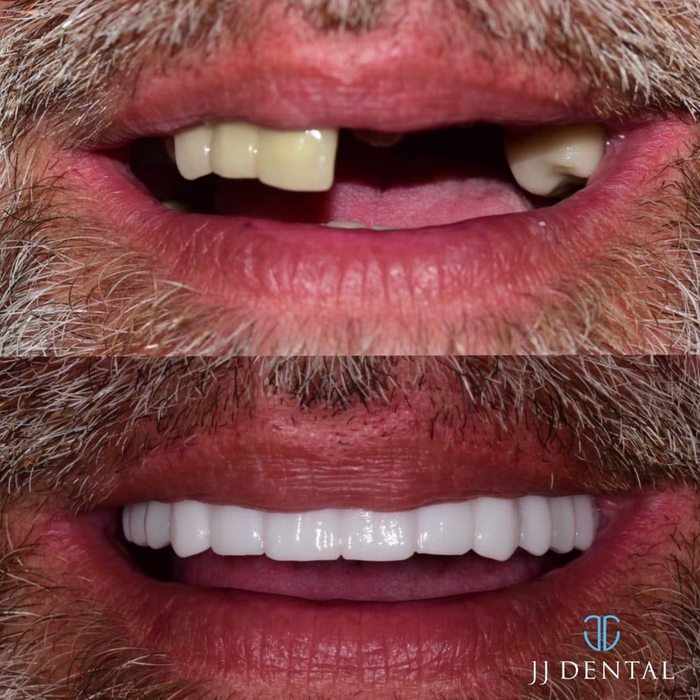 JJ Dental