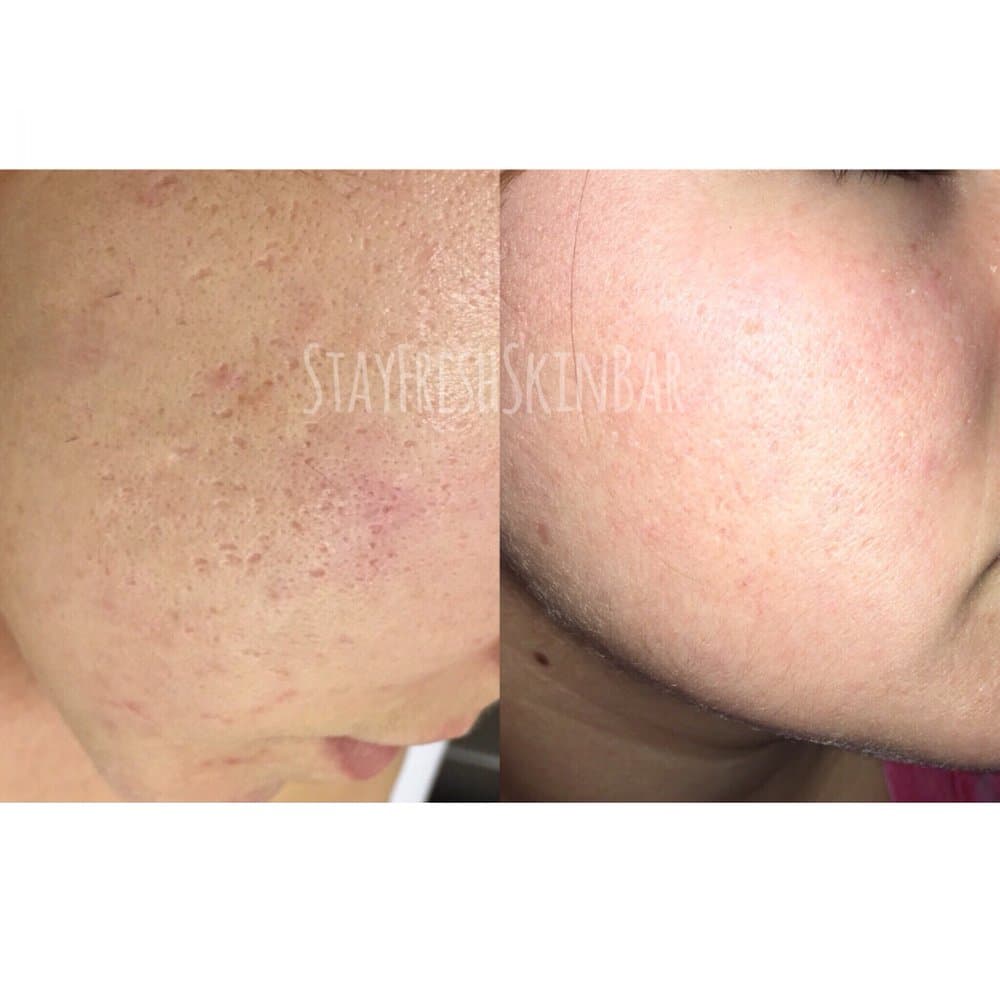 Stay Fresh Skin Bar