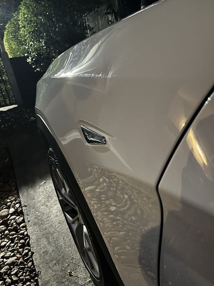 Dent Restorations