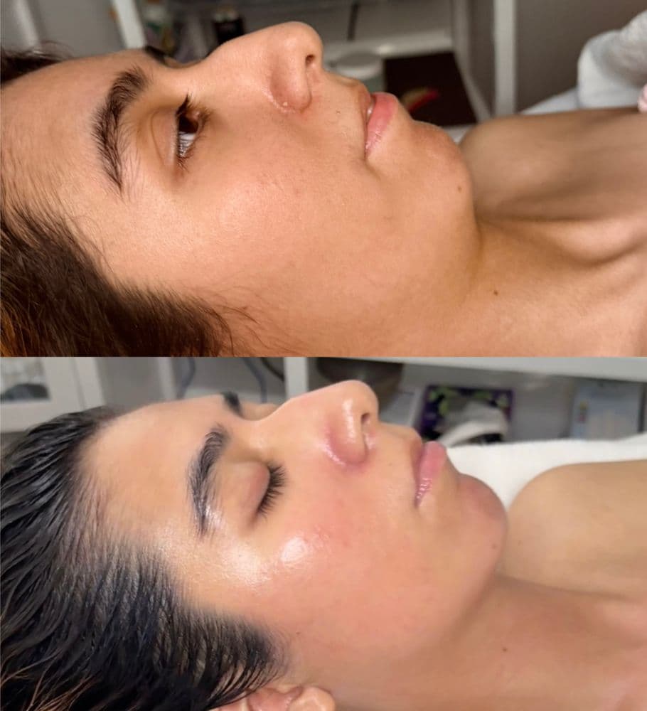 MB SkinCare