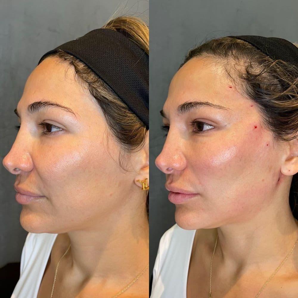 Facial Mania Med Spa - Kendall