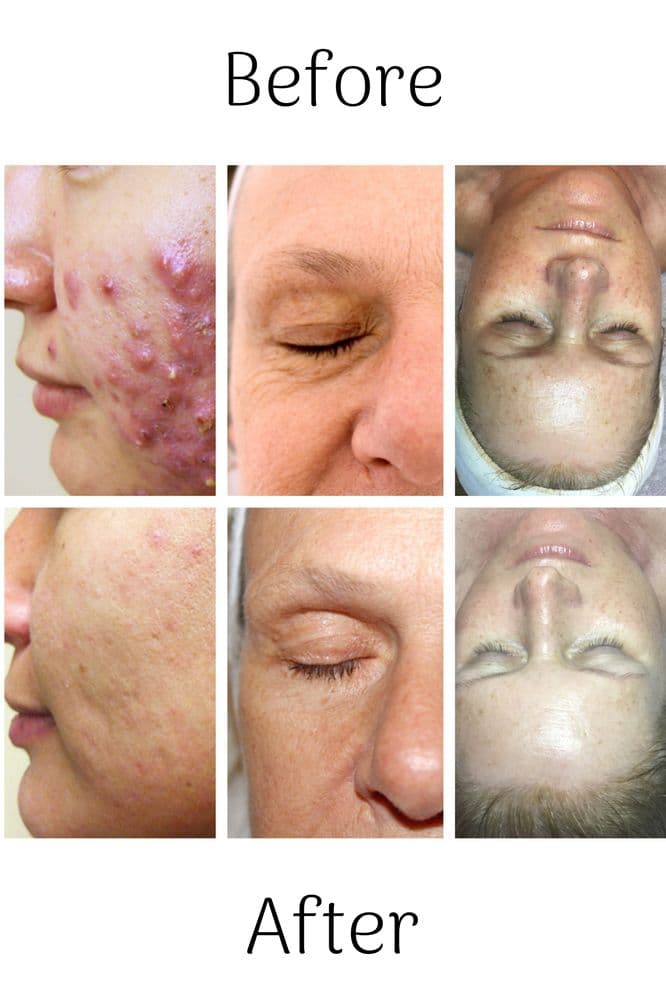 Holistic Skin Care Tampa