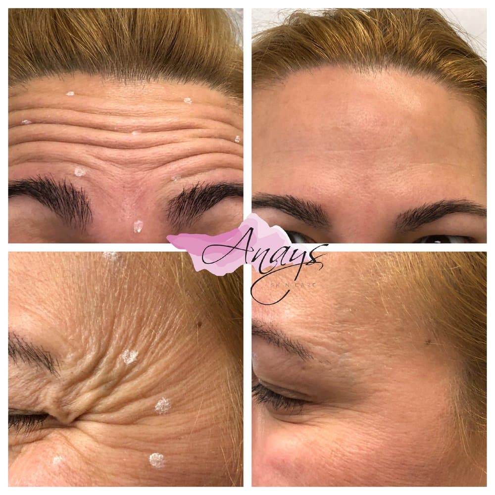 Anays Skin Care