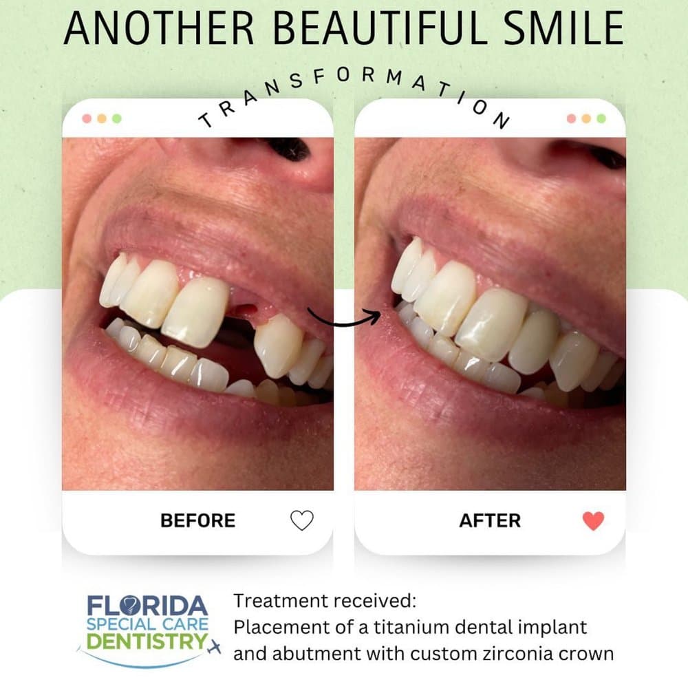 Florida Special Care Dentistry