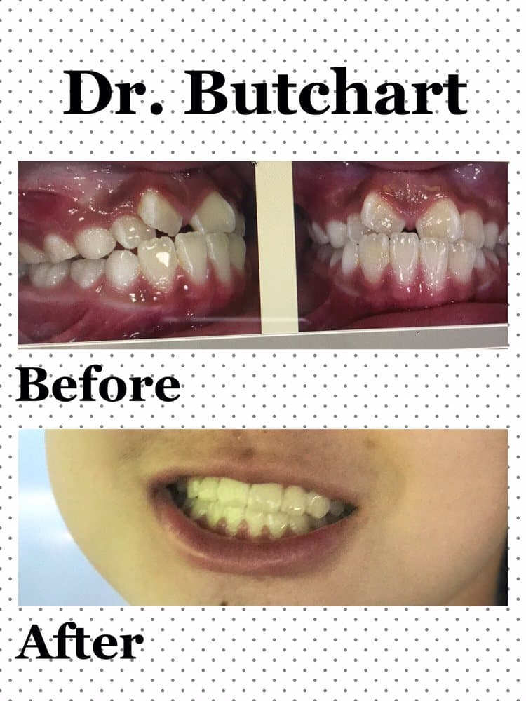 Butchart Orthodontics