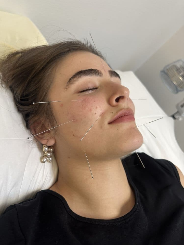 Gretel Acupuncture