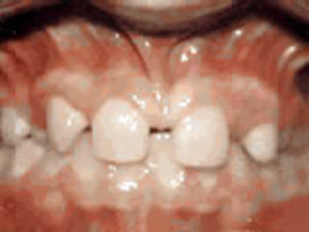 William F Mars, DDS - Marsh Orthodontics
