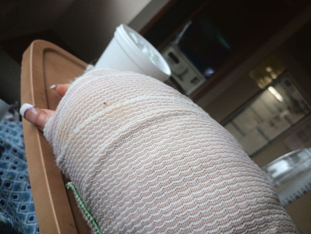 Winters & Yonker Personal Injury Lawyers